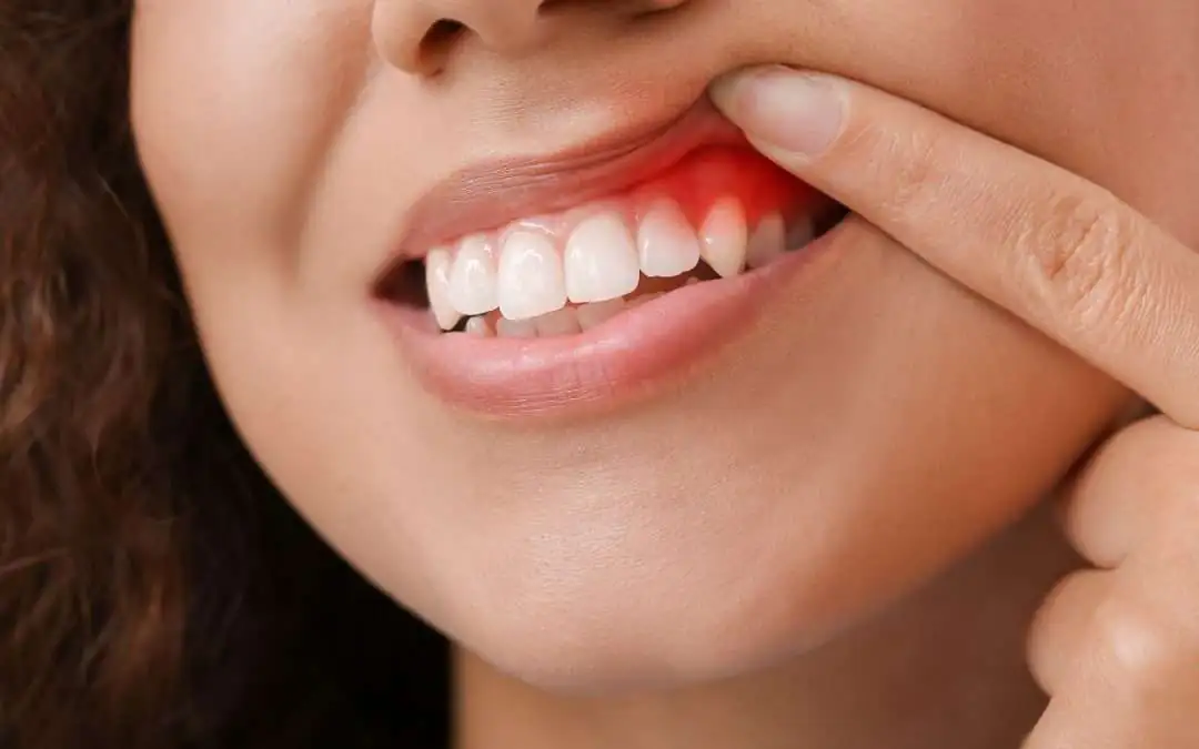 The Connection Between Gum Disease and Overall Health